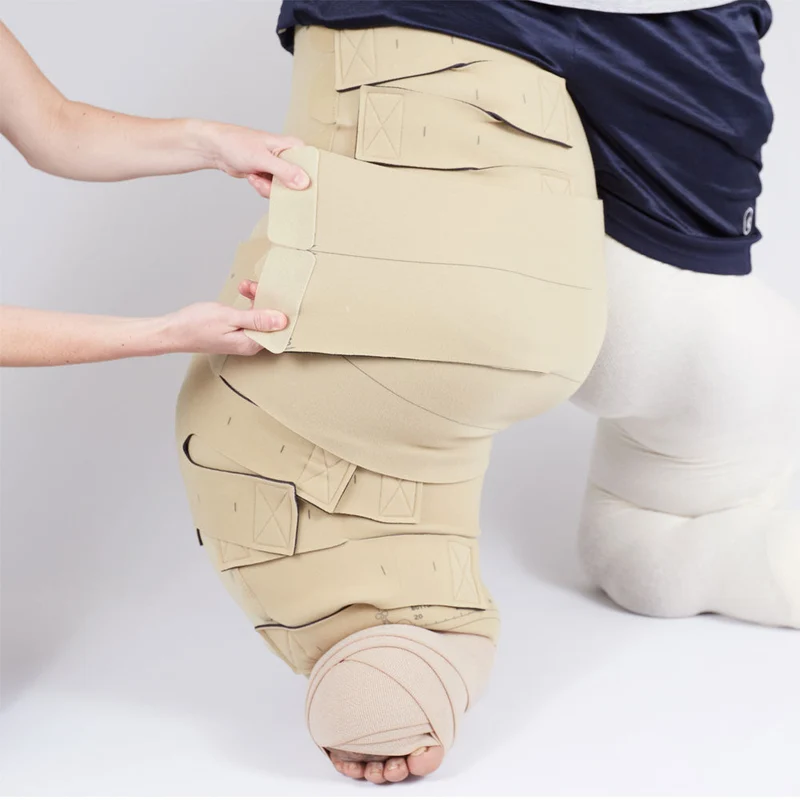 circaid reduction kit whole leg with lobe; lower leg long, upper leg standard
